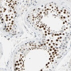 Anti-MLLT10 Antibody