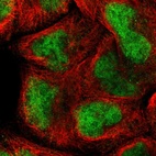 Immunofluorescent staining of human cell line A-431 shows localization to nucleoplasm.