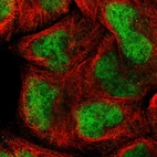 Immunofluorescent staining of human cell line A-431 shows localization to nucleoplasm.