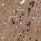 Immunohistochemical staining of human cerebral cortex shows moderate to strong positivity in neuronal cells.