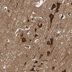 Immunohistochemical staining of human cerebral cortex shows moderate to strong positivity in neuronal cells.