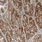 Immunohistochemical staining of human stomach shows moderate to strong positivity in glandular cells.