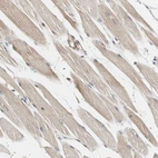 Immunohistochemical staining of human skeletal muscle shows weak positivity in myocytes.