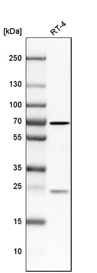 Western blot analysis in human cell line RT-4.