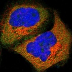 Immunofluorescent staining of human cell line A-431 shows localization to cytosol.