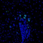 Immunofluorescence staining of mouse brain shows positivity in rostral migratory stream.