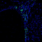 Immunofluorescence staining of mouse subventricular zone shows immunoreactivity in some cells in the rostral migratory stream.