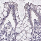 Immunohistochemical staining of human colon using Anti-PBK antibody HPA005753.