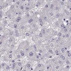 Anti-PBK Antibody