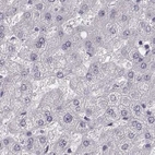 Immunohistochemical staining of human liver using Anti-PBK antibody HPA005753.