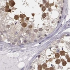Immunohistochemical staining of human testis using Anti-PBK antibody HPA005753.