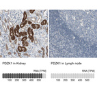 Anti-PDZK1 Antibody