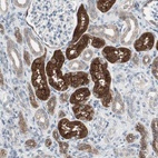 Immunohistochemical staining of human kidney shows high expression.
