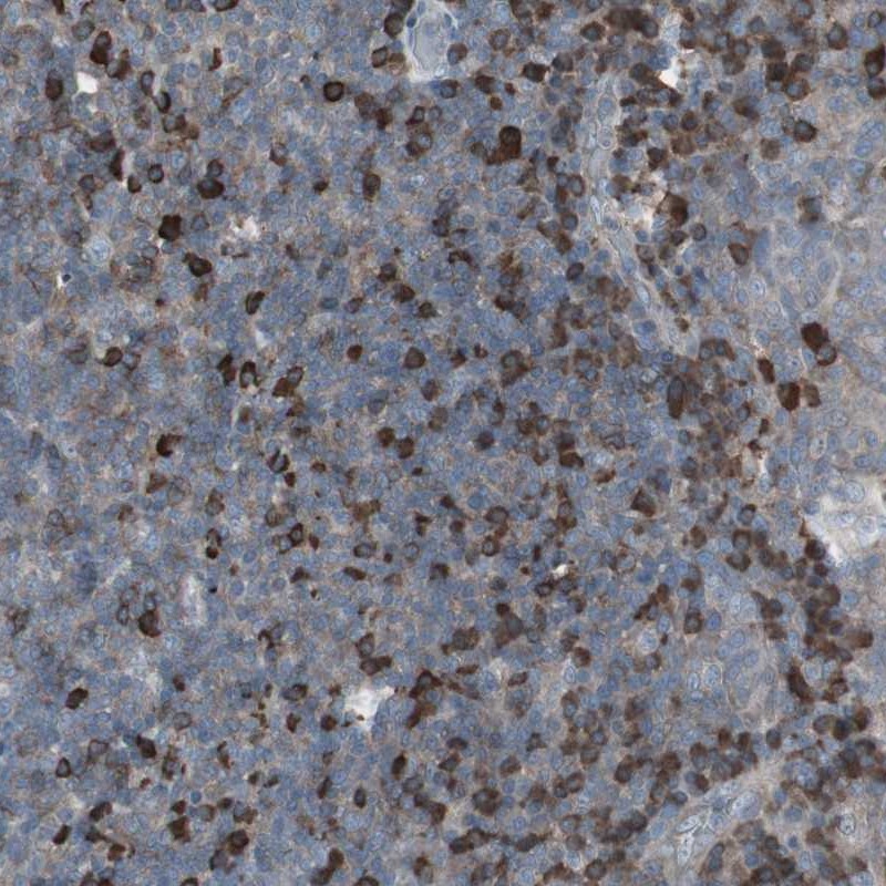 Anti-ZSCAN32 Antibody