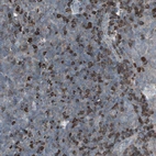 Anti-ZSCAN32 Antibody