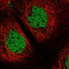 Immunofluorescent staining of human cell line A-431 shows localization to nucleoplasm.