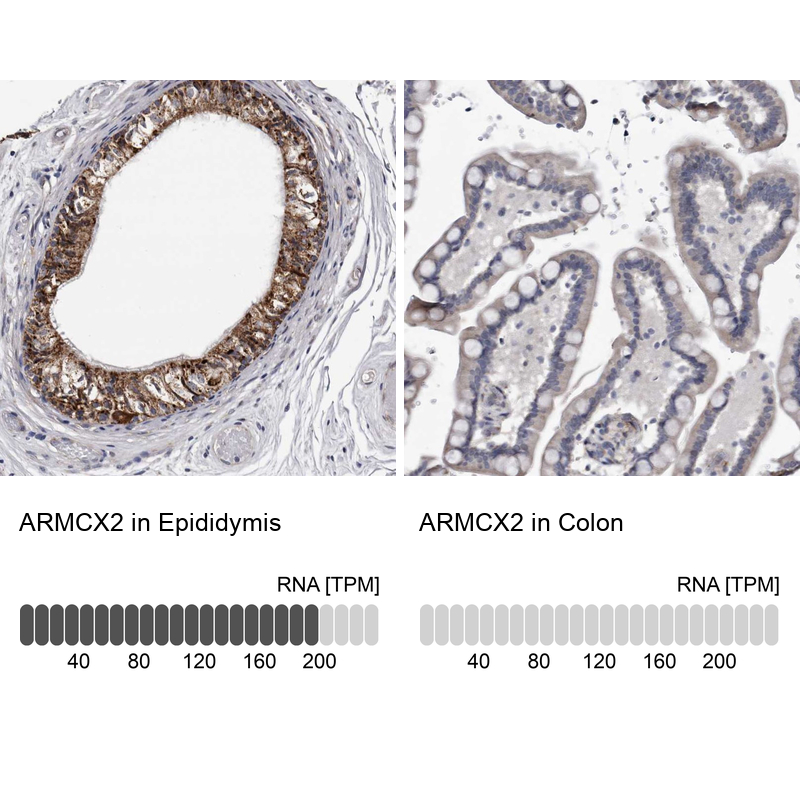 Anti-ARMCX2 Antibody