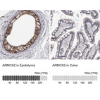 Anti-ARMCX2 Antibody