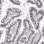 Immunohistochemical staining of human colon shows low expression as expected.