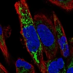 Immunofluorescent staining of human cell line RH-30 shows localization to mitochondria.
