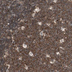 Anti-TCP11L1 Antibody