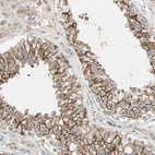 Anti-TTF2 Antibody