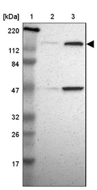 Lane 1: Marker [kDa] 220, 112, 84, 47, 32, 26, 17_br/_Lane 2: Human cell line RT-4_br/_Lane 3: Human cell line U-251MG sp