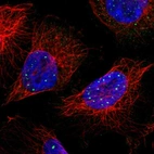 Immunofluorescent staining of human cell line U-251 MG shows localization to nuclear bodies.