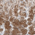 Anti-GART Antibody