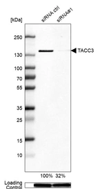 Western blot analysis in HEK293 cells transfected with control siRNA, target specific siRNA probe #1, using Anti-TACC3 antibody. Remaining relative intensity is presented. Loading control: Anti-GAPDH.
