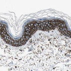 Immunohistochemical staining of human skin shows strong membranous positivity in squamous epithelial cells.