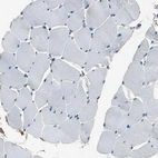 Staining of human skeletal muscle shows no positivity in striated muscle fibers as expected.