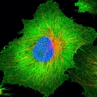 Immunofluorescent staining of human cell line U-251 MG shows localization to plasma membrane.