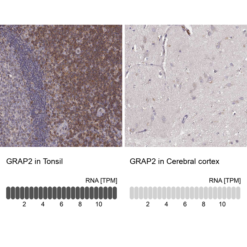 Anti-GRAP2 Antibody