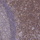 Anti-GRAP2 Antibody