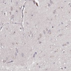 Anti-GRAP2 Antibody