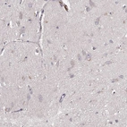 Immunohistochemical staining of human cerebral cortex shows low expression as expected.