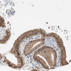 Anti-ZBTB17 Antibody