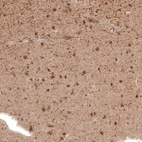 Immunohistochemical staining of human cerebral cortex shows moderate cytoplasmic positivity.