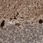 Immunohistochemical staining of human cerebellum shows strong cytoplasmic positivity in Purkinje cells.