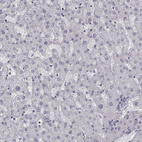 Immunohistochemical staining of human liver shows no cytoplasmic positivity in hepatocytes as expected.
