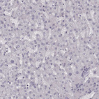 Anti-PCP4 Antibody