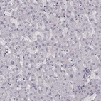 Immunohistochemical staining of human liver shows no cytoplasmic positivity in hepatocytes as expected.