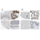 Immunohistochemical staining of human esophagus, placenta, skeletal muscle and skin using Anti-GRHL1 antibody HPA005798 (A) shows similar protein distribution across tissues to independent antibody HPA006420 (B).