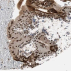 Immunohistochemical staining of human placenta shows strong nuclear positivity in trophoblastic cells.