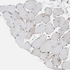 Immunohistochemical staining of human skeletal muscle shows no positivity in myocytes as expected.