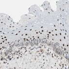 Immunohistochemical staining of human esophagus shows moderate to strong nuclear positivity in squamous epithelial cells.