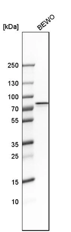 Western blot analysis in human cell line BEWO.