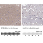 Anti-CACNG4 Antibody