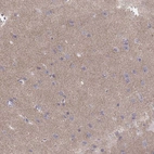 Immunohistochemical staining of human cerebral cortex shows moderate positivity in neuropil.